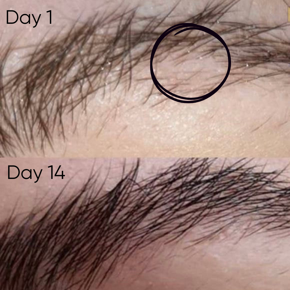 Izabell Eyebrow Growth Roller